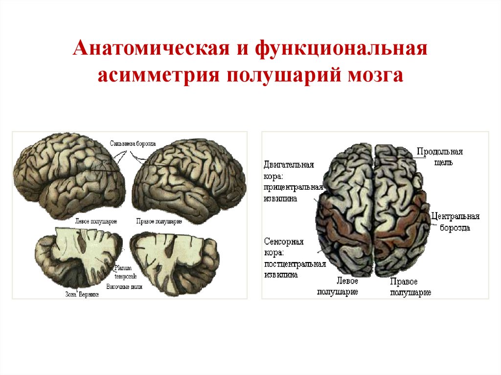 Функциональная асимметрия мозга картинки