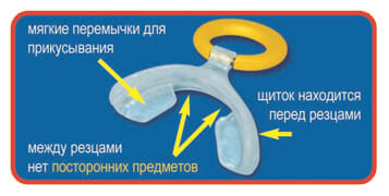 как устроено