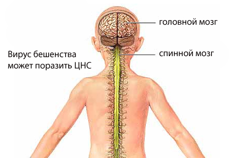 бешенство у детей